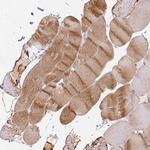 CaV1.1 Antibody in Immunohistochemistry (Paraffin) (IHC (P))