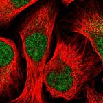 STK33 Polyclonal Antibody