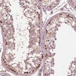 STK33 Antibody in Immunohistochemistry (Paraffin) (IHC (P))