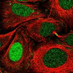 XPA Antibody in Immunocytochemistry (ICC/IF)