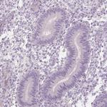 Desmoglein 3 Antibody in Immunohistochemistry (Paraffin) (IHC (P))