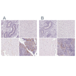 Desmoglein 3 Polyclonal Antibody