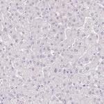 Desmoglein 3 Antibody in Immunohistochemistry (Paraffin) (IHC (P))