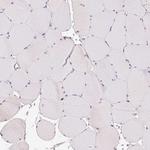 Desmoglein 3 Antibody in Immunohistochemistry (Paraffin) (IHC (P))
