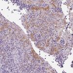 Desmoglein 3 Antibody in Immunohistochemistry (Paraffin) (IHC (P))