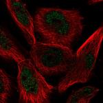 AP2 alpha Polyclonal Antibody