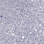 AP2 alpha Antibody in Immunohistochemistry (Paraffin) (IHC (P))