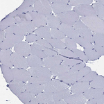 AP2 alpha Antibody in Immunohistochemistry (Paraffin) (IHC (P))