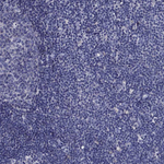 AP2 alpha Antibody in Immunohistochemistry (Paraffin) (IHC (P))