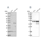 AP2 alpha Antibody in Western Blot (WB)