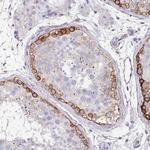 Drebrin Antibody in Immunohistochemistry (Paraffin) (IHC (P))