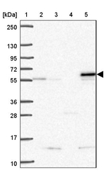 SARS2 Antibody in Western Blot (WB)