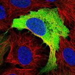 RRM2 Polyclonal Antibody