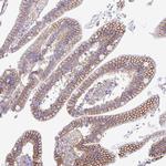 RRM2 Antibody in Immunohistochemistry (Paraffin) (IHC (P))