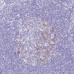 RRM2 Antibody in Immunohistochemistry (Paraffin) (IHC (P))