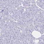 RRM2 Antibody in Immunohistochemistry (Paraffin) (IHC (P))