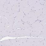 RRM2 Antibody in Immunohistochemistry (Paraffin) (IHC (P))