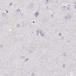 CSN1S1 Antibody in Immunohistochemistry (Paraffin) (IHC (P))