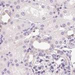 CSN1S1 Antibody in Immunohistochemistry (Paraffin) (IHC (P))
