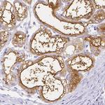CSN1S1 Antibody in Immunohistochemistry (Paraffin) (IHC (P))