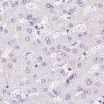 CSN1S1 Antibody in Immunohistochemistry (Paraffin) (IHC (P))