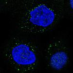 LIPA Polyclonal Antibody