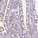 LIPA Antibody in Immunohistochemistry (Paraffin) (IHC (P))