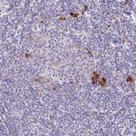 LIPA Antibody in Immunohistochemistry (Paraffin) (IHC (P))