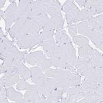 LIPA Antibody in Immunohistochemistry (Paraffin) (IHC (P))