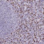LIPA Antibody in Immunohistochemistry (Paraffin) (IHC (P))