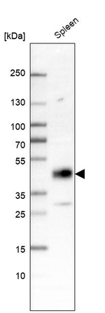 LIPA Antibody in Western Blot (WB)