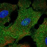 NAP1L2 Polyclonal Antibody