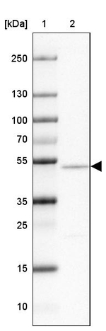NAP1L2 Antibody in Western Blot (WB)