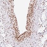 PRDM11 Polyclonal Antibody