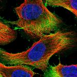 UBE2S Polyclonal Antibody