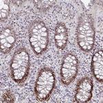 GINS2 Antibody in Immunohistochemistry (Paraffin) (IHC (P))