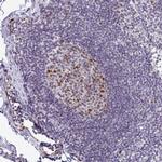GINS2 Antibody in Immunohistochemistry (Paraffin) (IHC (P))