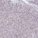 GINS2 Antibody in Immunohistochemistry (Paraffin) (IHC (P))