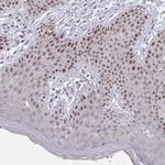 GINS2 Antibody in Immunohistochemistry (Paraffin) (IHC (P))