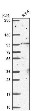 BCAS3 Antibody in Western Blot (WB)