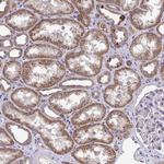 XAF1 Antibody in Immunohistochemistry (Paraffin) (IHC (P))