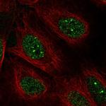 POLK Polyclonal Antibody