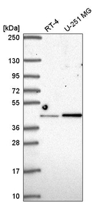 IRF2 Antibody in Western Blot (WB)