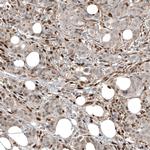 FOXR2 Antibody in Immunohistochemistry (Paraffin) (IHC (P))