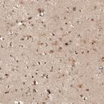 FOXR2 Antibody in Immunohistochemistry (Paraffin) (IHC (P))