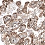 FOXR2 Antibody in Immunohistochemistry (Paraffin) (IHC (P))