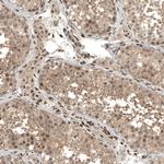 FOXR2 Antibody in Immunohistochemistry (Paraffin) (IHC (P))