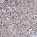 BRCA1 Polyclonal Antibody