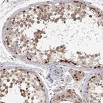 BRCA1 Antibody in Immunohistochemistry (Paraffin) (IHC (P))