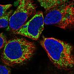 KLHL29 Polyclonal Antibody